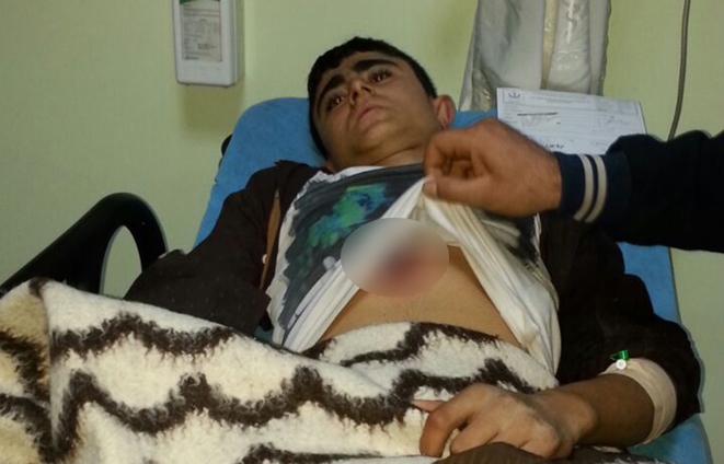PKK'liler ile polis çatıştı yoldan geçen çocuk yaralandı